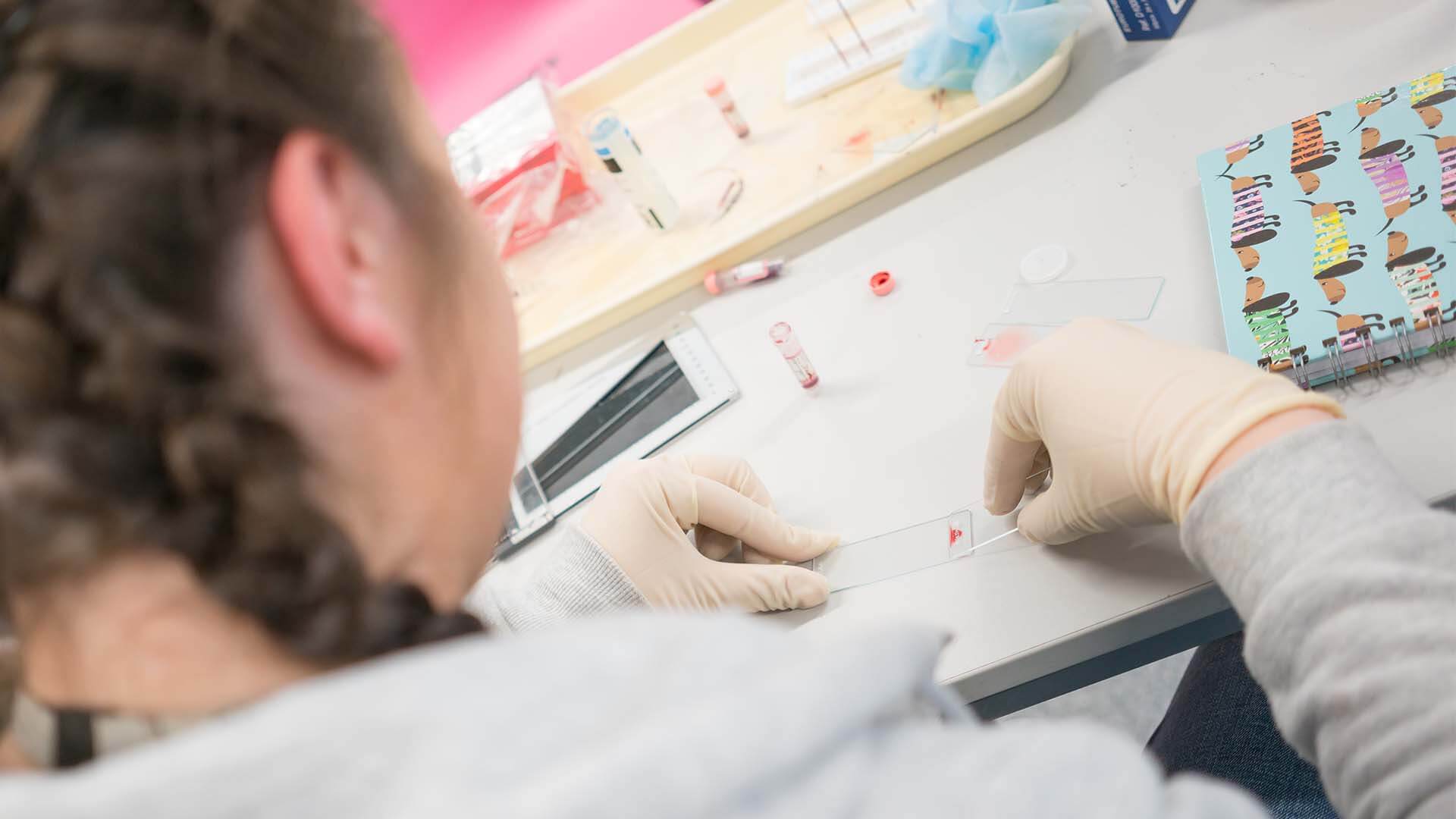 A young woman testing a blood sample.